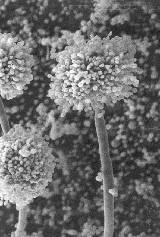 Aspergillus-SVEP_2 Aspergillus